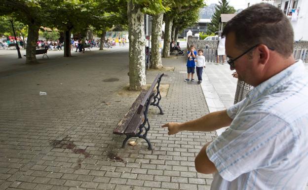 El joven agredido en Liendo será operado en los próximos días