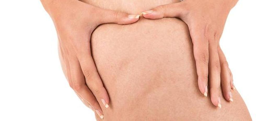 El truco para evitar la celulitis está en lo que comes