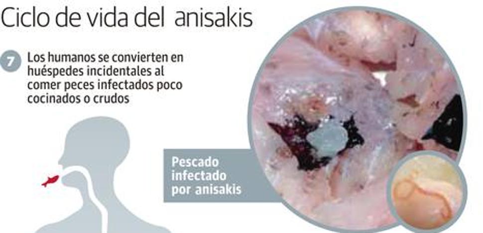 La alergia al anisakis se dispara y afecta al 5% de los cántabros