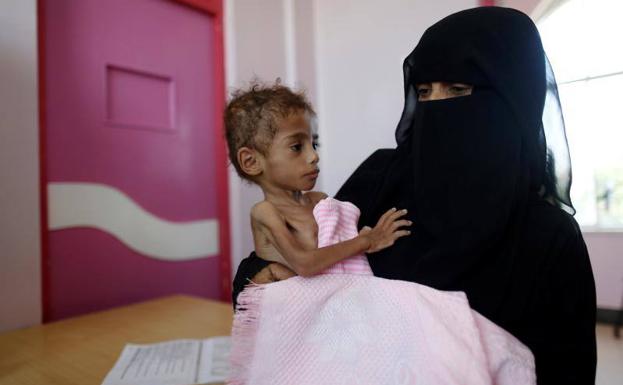 Unicef denuncia que los niños de Yemen «están muriendo de hambre y enfermedades»