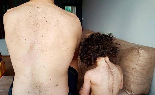 El fiscal pide informes forenses de las lesiones de los niños afectados por el falso omeprazol