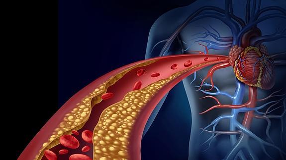 ¿Las enfermedades tiroideas aumentan el riesgo cardiovascular?