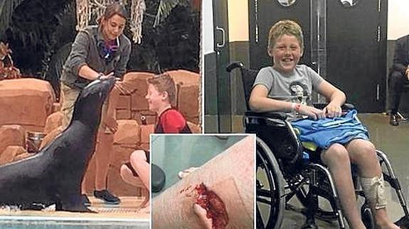 Herido un niño de 10 años al atacarle un león marino en un zoo de Tenerife