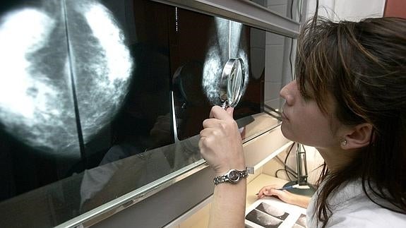 Cantabria reducirá la espera para pruebas complementarias de cáncer de mama