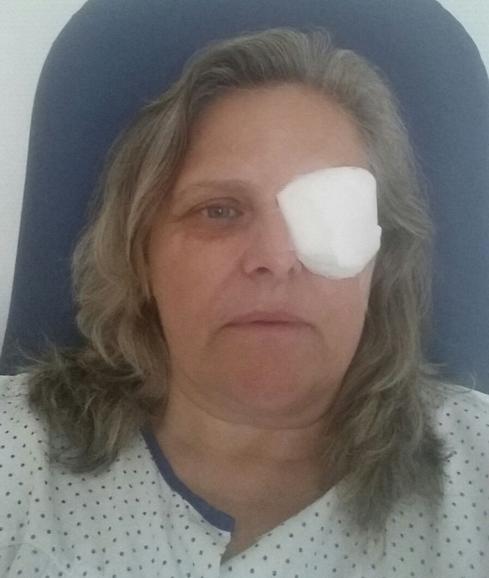 Una mujer pierde un ojo tras recibir el impacto de un objeto mientras se bañaba en Torremolinos