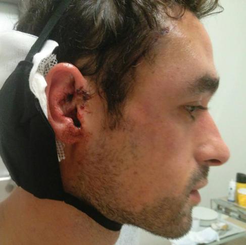 Un futbolista cántabro sufre una agresión durante un partido en Alemania