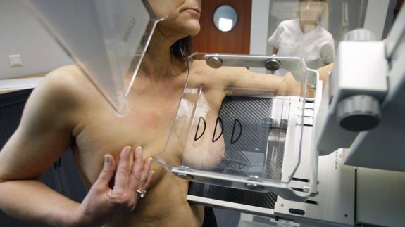 El cribado de cáncer de mama diagnostica cuatro casos por cada mil mujeres exploradas