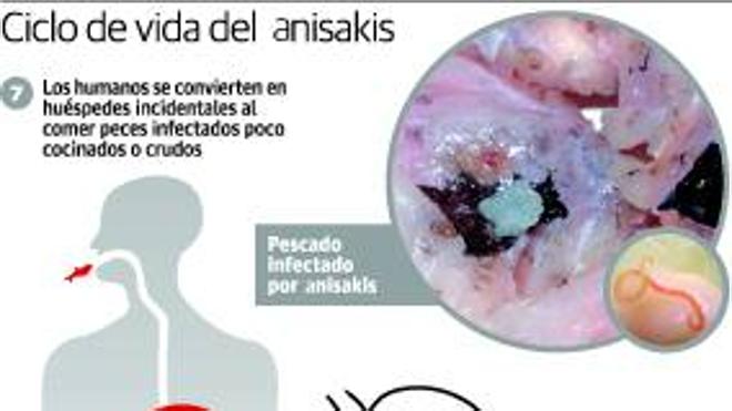 Cantabria encabeza las infecciones por anisakis tras consumir boquerones